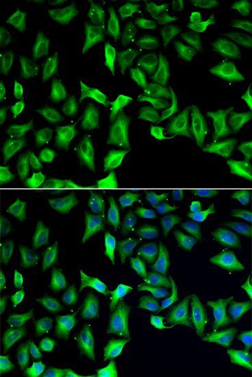 Western blot - GDA Polyclonal Antibody (144-06441)