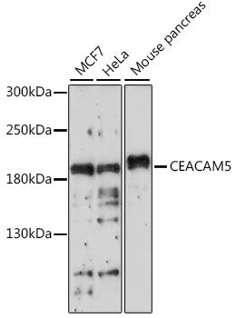 Western blot - CEACAM5 Polyclonal Antibody (144-60045)