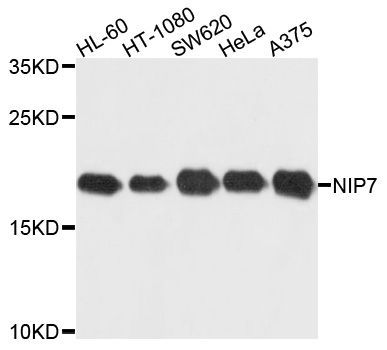 Western blot - NIP7 antibody (144-04734)
