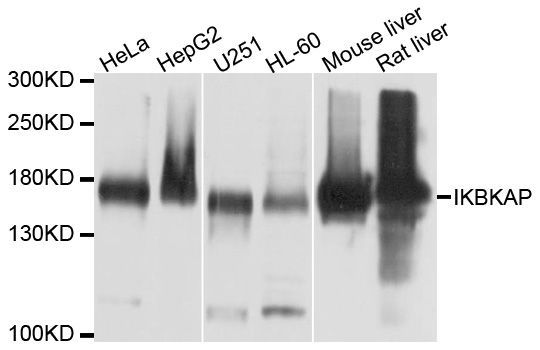 Western blot - IKBKAP Polyclonal Antibody (144-10127)