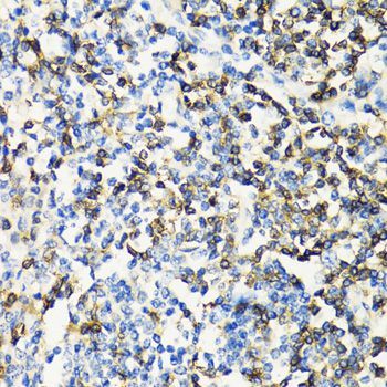 Immunohistochemistry - CD3E Polyclonal Antibody (144-01753)