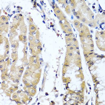 Immunohistochemistry - COL9A1 antibody (144-06563)