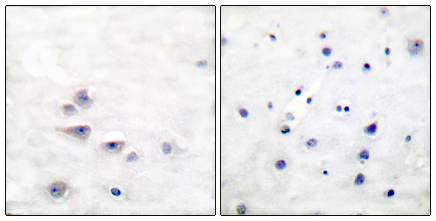IHC