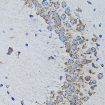 Western blot - [KO Validated] PTPN1 Polyclonal Antibody (144-01590)