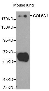 Western blot - COL5A1 antibody (144-01515)