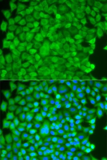 Immunofluorescence - SGCE antibody (144-05330)
