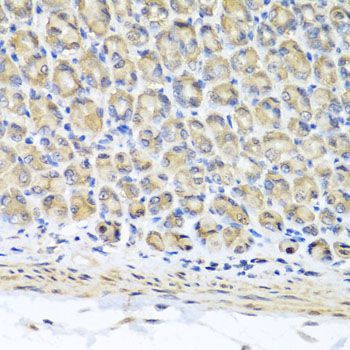 Immunohistochemistry - STK3 Polyclonal Antibody (144-06992)