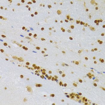 Immunohistochemistry - HMGB1 Polyclonal Antibody (144-02553)