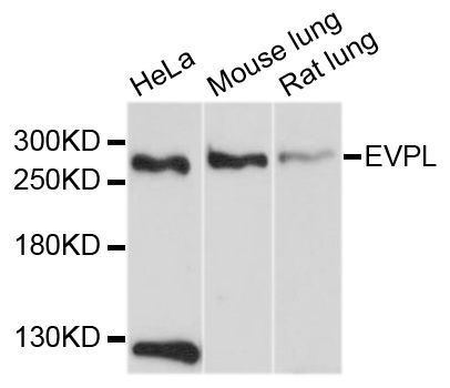 Western blot - EVPL Polyclonal Antibody (144-010215)