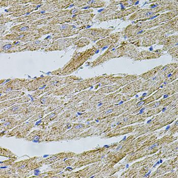 Immunohistochemistry - TRPA1 Polyclonal Antibody (144-08568)