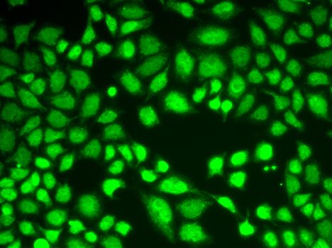 Western blot - [KO Validated] KDM1A Polyclonal Antibody (144-01156)