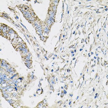 Immunohistochemistry - PIK3CB antibody (144-00982)