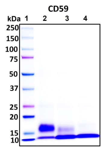 SDS-PAGE Image