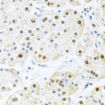 Immunohistochemistry - BCCIP Polyclonal Antibody (144-08586)