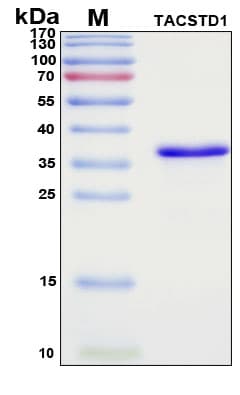 SDS-PAGE Image