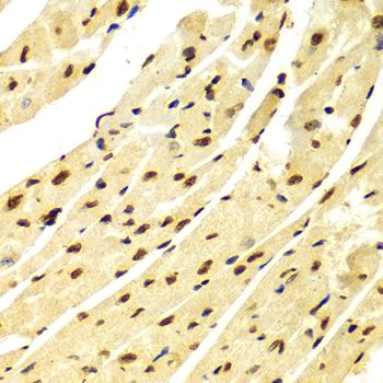 Immunohistochemistry - DiMethyl-Histone H3-K79 antibody (144-61341)