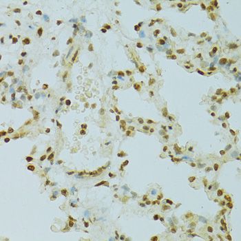 Immunohistochemistry - RCC1 Polyclonal Antibody (144-06350)
