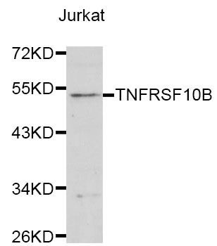 Western blot - TNFRSF10B antibody (144-01236)