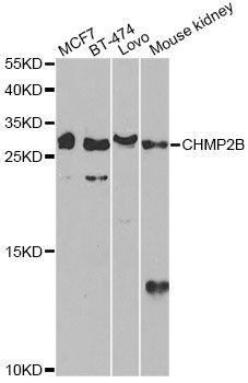 Western blot - CHMP2B antibody (144-013410)