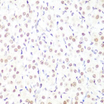 Immunohistochemistry - MonoMethyl-Histone H3-K9 pAb (144-02358)