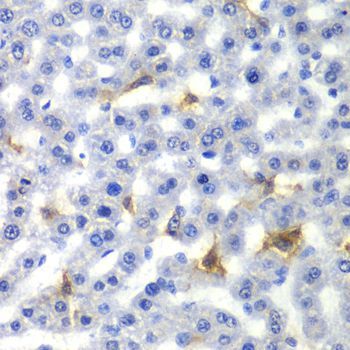 Immunohistochemistry - NR0B2 antibody (144-01836)