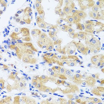 Immunohistochemistry - INADL antibody (144-08476)