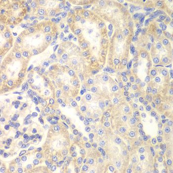 Immunohistochemistry - DLC1 antibody (144-01921)