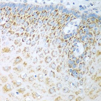 Immunohistochemistry - FDXR antibody (144-03860)