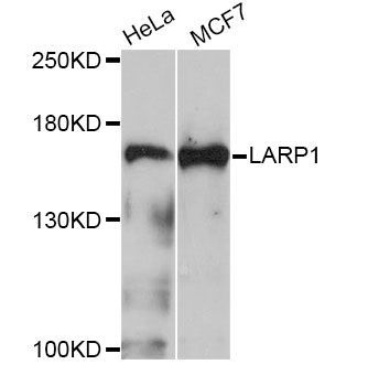 Western blot - LARP1 Antibody (144-04543)