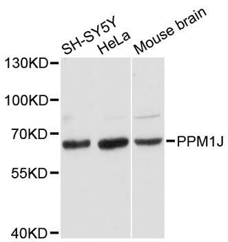 Western blot - PPM1J antibody (144-12844)