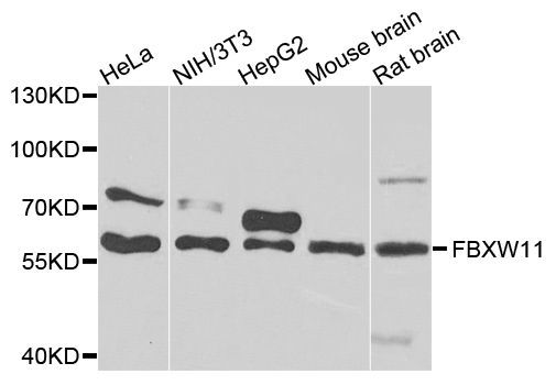 Western blot - FBXW11 antibody (144-07784)
