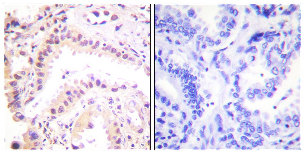 IHC