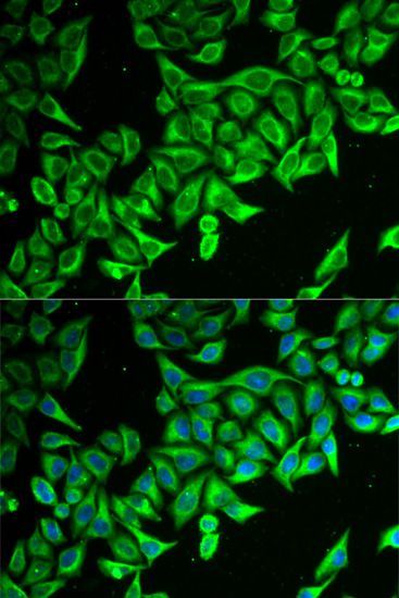 Immunofluorescence - DAP Polyclonal Antibody (144-06150)