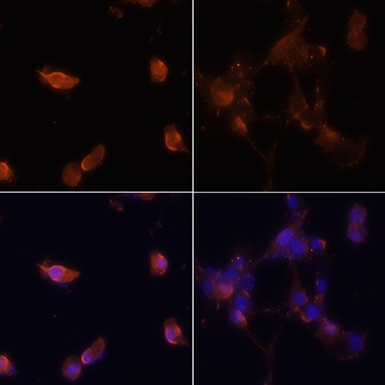 Immunofluorescence - MAP1LC3B Polyclonal Antibody (144-11282)
