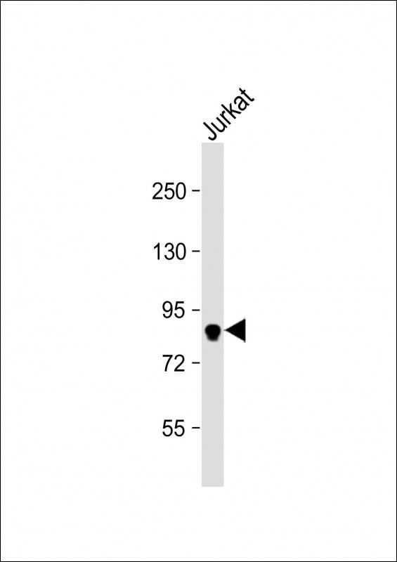 WB