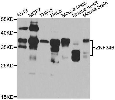 Western blot - ZNF346 antibody (144-07507)
