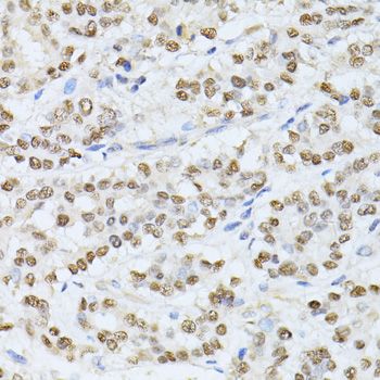 Immunohistochemistry - SATB1 antibody (144-05800)