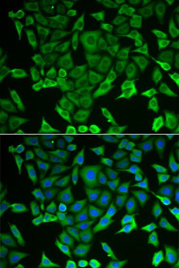 Immunofluorescence - RARS antibody (144-06307)