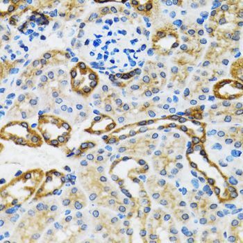 Immunohistochemistry - Caspase3 Polyclonal Antibody (144-60067)