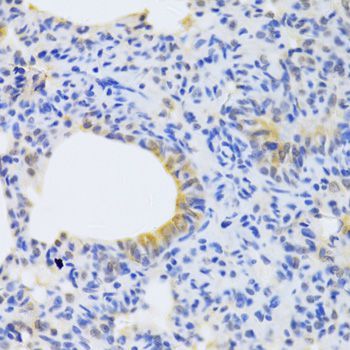 Immunohistochemistry - MRPS30 Polyclonal Antibody (144-05841)