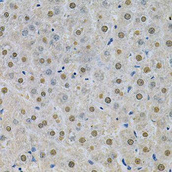 Immunohistochemistry - SPHK1 Polyclonal Antibody (144-00139)