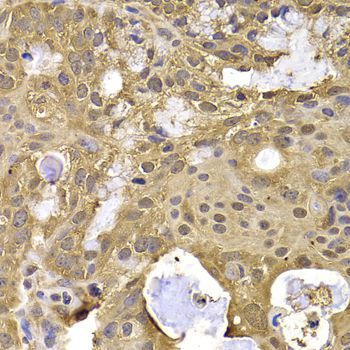 Immunohistochemistry - NAA20 Polyclonal Antibody (144-07105)
