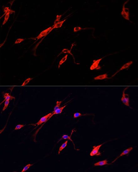 Immunofluorescence - ENO2 antibody (144-012341)