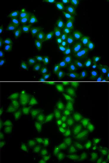 Western blot - [KO Validated] SAMHD1 Polyclonal Antibody (144-07794)