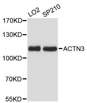 Western blot - ACTN3 Polyclonal Antibody (144-12797)