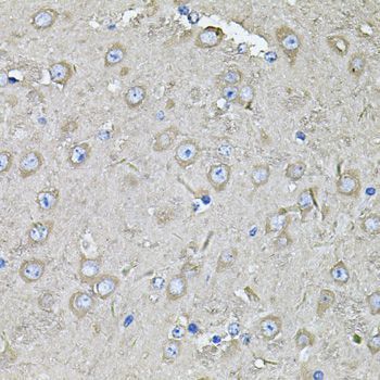 Immunohistochemistry - EIF3C Polyclonal Antibody (144-07022)