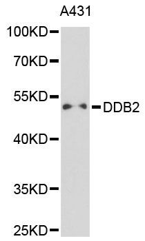 Western blot - DDB2 antibody (144-01848)