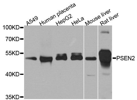 Western blot - PSEN2 Polyclonal Antibody (144-07719)