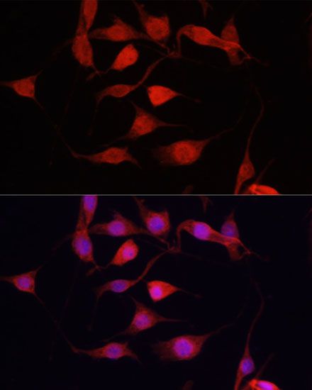 Immunofluorescence - YAP1 Polyclonal Antibody (144-01001)