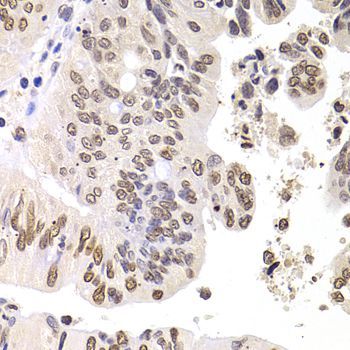 Immunohistochemistry - SOX5 Polyclonal Antibody (144-06985)